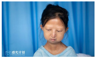 100万善款只收到2万，儿童慈善机构9958还有良心吗